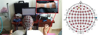 High Classification Accuracy of a Motor Imagery Based Brain-Computer Interface for Stroke Rehabilitation Training